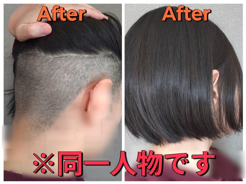 女性のインナー刈り上げビフォーアフター比較